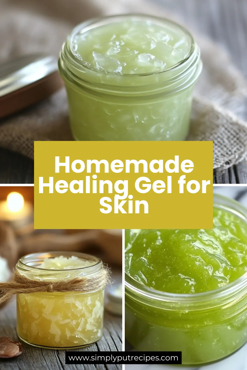 Homemade Healing Gel for Skin – Natural Aloe Vera Remedies Collage of jars filled with homemade aloe vera healing gel in green and yellow tones
